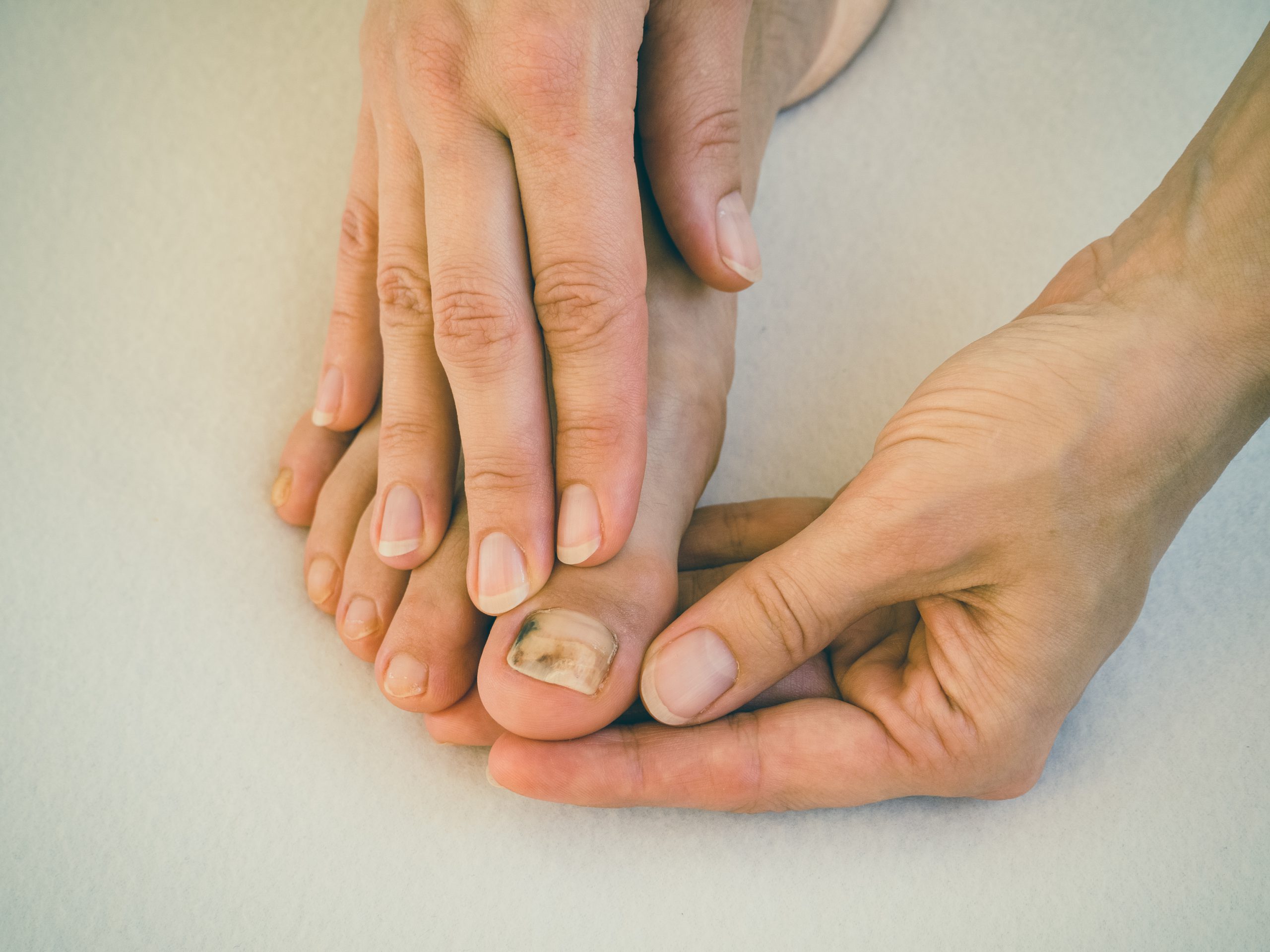 brzydkie paznokcie u stop pokonaj ten problem boskie stopy boze narodzenie czerwone i zielone milosc do zdobienia paznokci